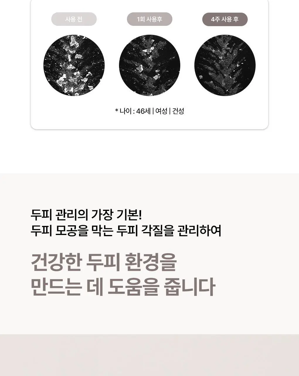 [비듬각질정화SET]라우쉬 콜츠푸트 안티-댄드러프 샴푸200ml&로션200ml 기획 상세페이지 12